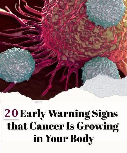 20 Early Warning Signs of Cancer You Should Never Ignore