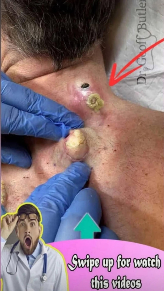 SEVEN THINGS THAT CLOG YOUR PORES AND CAUSE ACNE