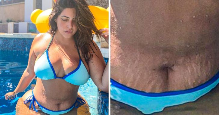 Ten+ Forced Beauty Standards That Everyone Should Abandon
