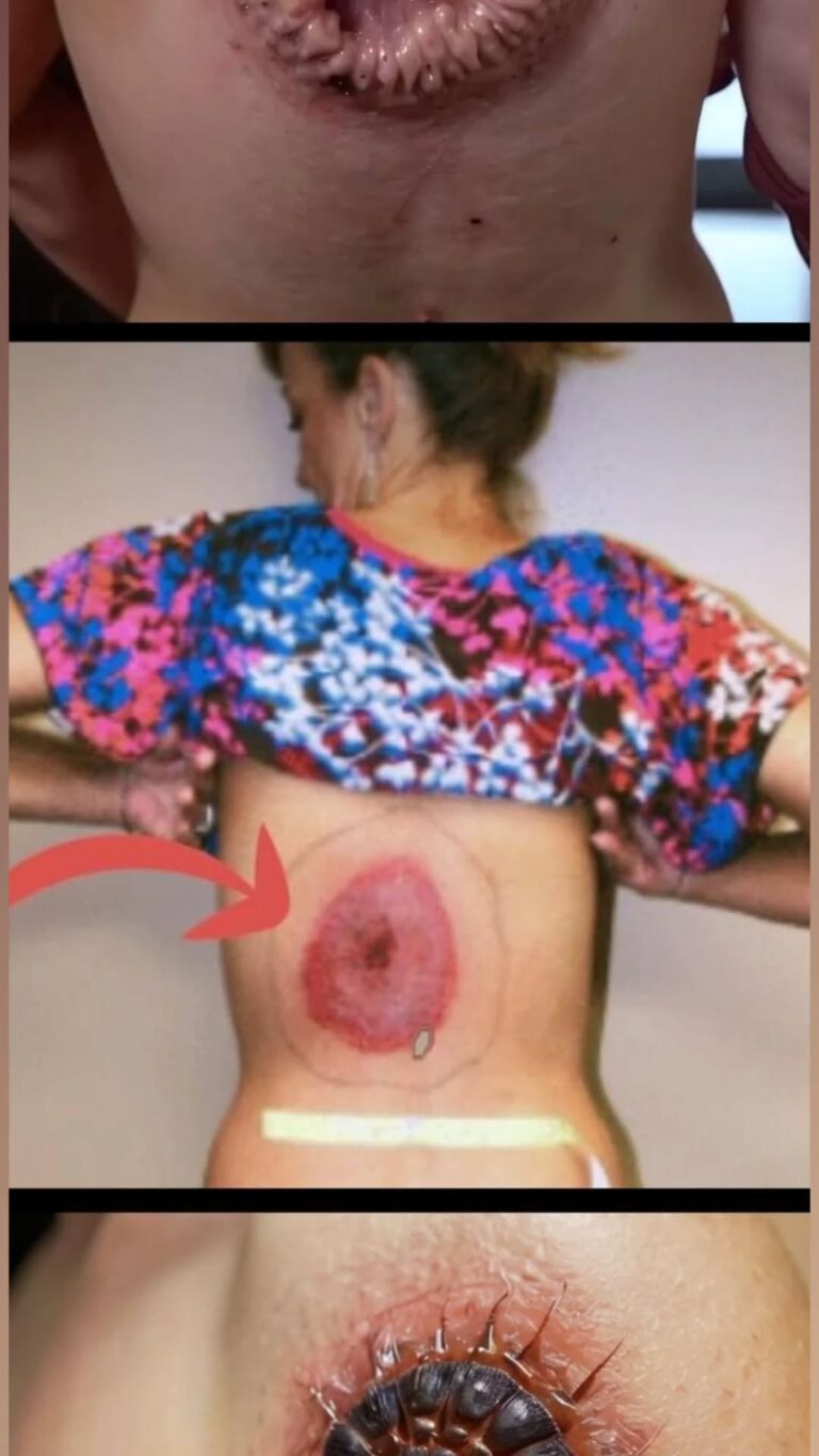 10 Signs Your Body Can Be Signaling a Real Trouble