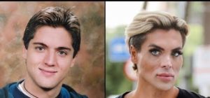 A “BRAZILIAN Ken Doll” Spent 1 MILLION Dollars on Plastic Surgeries to Look Like a Barbie😱