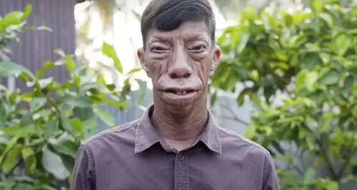 Family with mysterious facial condition are becoming an internet sensation – now they’re inspiring millions worldwide