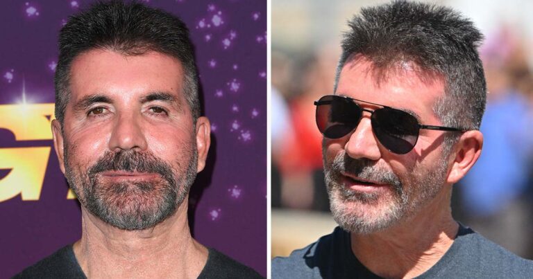 Simon Cowell feared he’d never walk again after horror accident