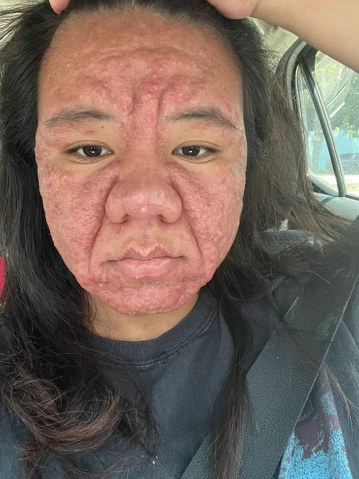 28-Year-Old Woman Reveals the Raw Truth of How Pregnancy Drastically Changes Her Face