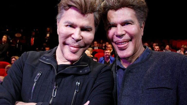 🤯Due to numerous plastic surgeries, these brothers have severely altered their appearance. 😓What did they look like before?