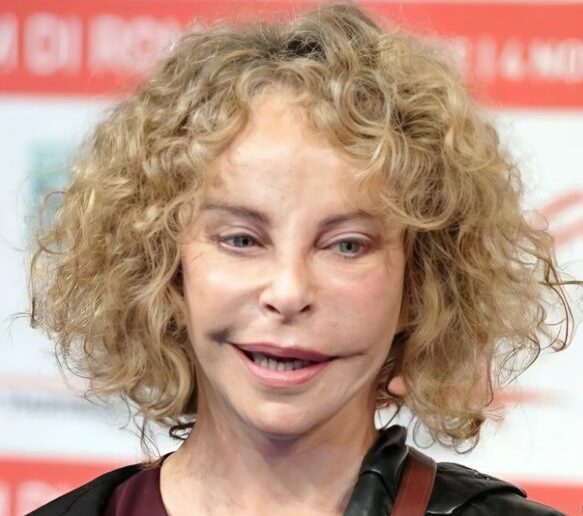 She was once a favorite of millions thanks to her unusual appearance, but has changed dramatically due to plastic surgery.