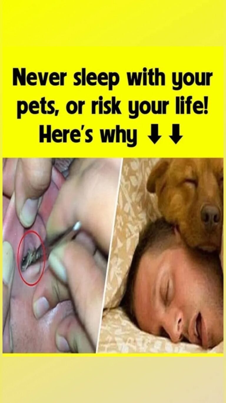 Don’t sleep with your pets, don’t risk your life, here’s why