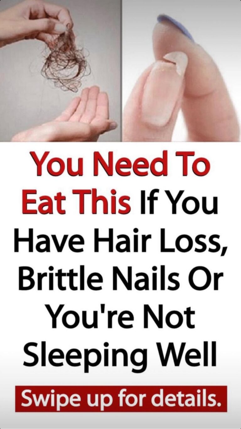 If you have brittle nails, hair loss, or poor sleep, you should eat this