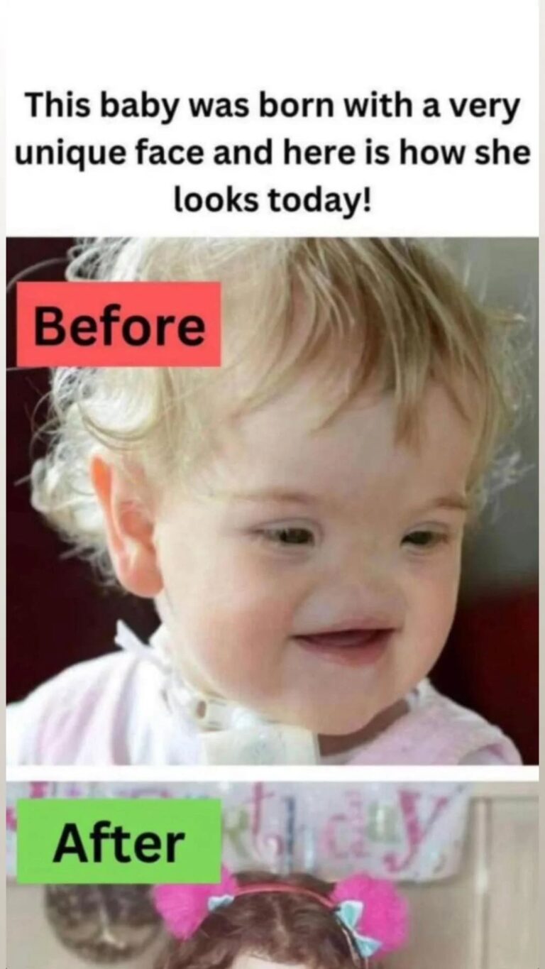 Tessa’s Journey That Defied All Odds