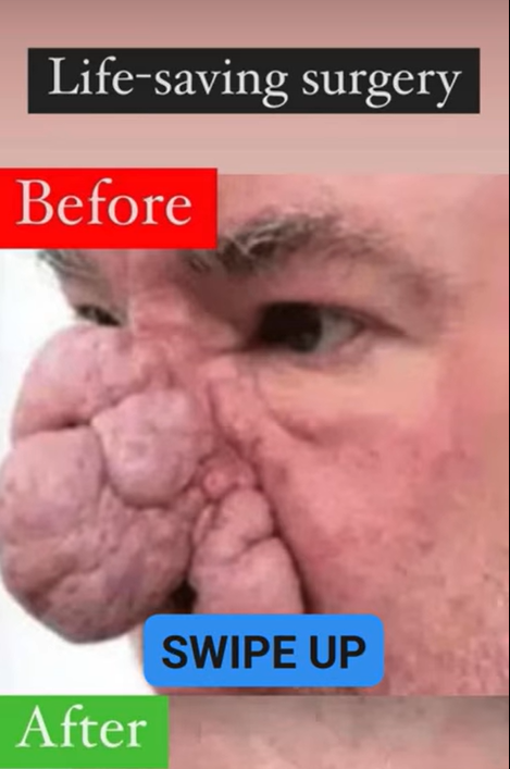 Until I had a face transplant after 50 hours of surgery, I was stared at. It’s the best gift. I’m looking for a wife right now…